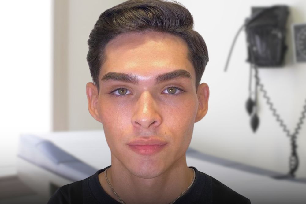 Después